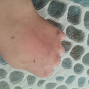 Yves Rocher Nemlendirici Krem Mağduriyeti