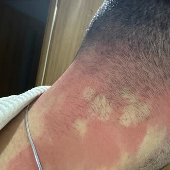 Sebamed Şampuan Resmen Haşladı!