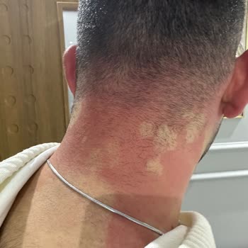 Sebamed Şampuan Resmen Haşladı!