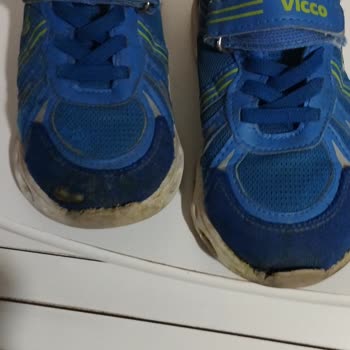 Vicco 45 Günlük Ayakkabıda Açılma Ve Sökülme