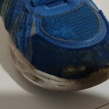 Vicco 45 Günlük Ayakkabıda Açılma Ve Sökülme