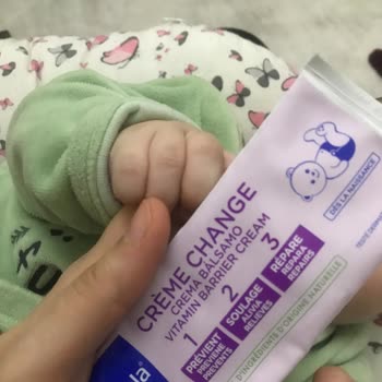 Mustela Bebek Pişik Kreminin Beklenmedik Yan Etkisi!