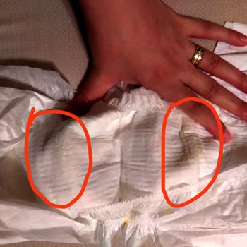 Molfix Bez Aşırı Kimyasal Kokusu, Bezlerde Leke Var