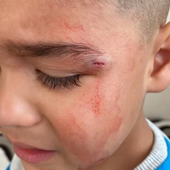 Gebze Medical Park Hastanesinin Bilgisizliği İlgisizliği