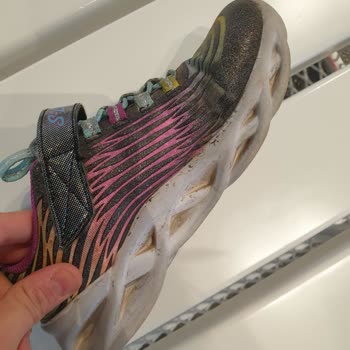 Skechers Yırtılma Ve Aşırı Koku Sorunu