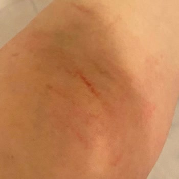 Nazmiye Aksu Fashion House Mağduriyet