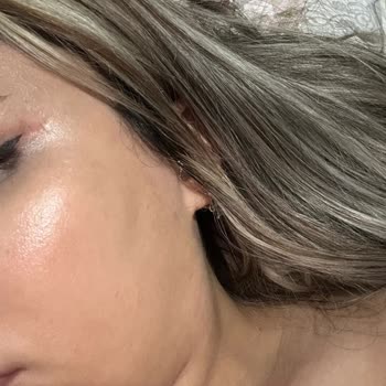 Özel Hürrem Sultan Hastanesi Hastalarını Mağdur Etmesi