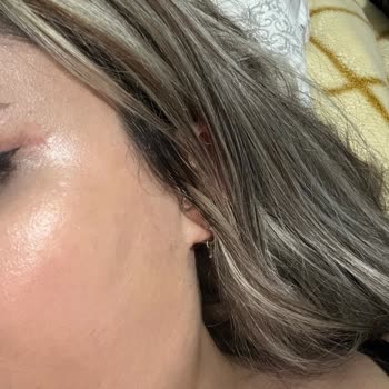 Özel Hürrem Sultan Hastanesi Hastalarını Mağdur Etmesi