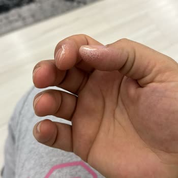 Bosch Çamaşır Makinesi Çıkmayan Lekeler