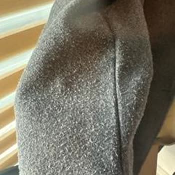 Yeni Alınan Bir Zara Ürününde Tüylenme Sorunu