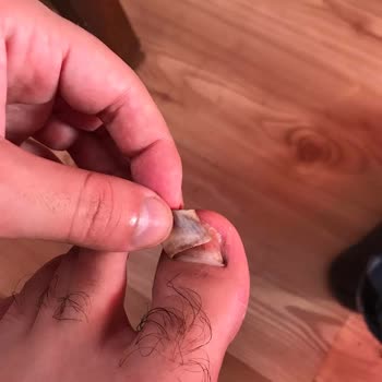 Lastik Pabuç Ayak Sağlığımdan Oldum