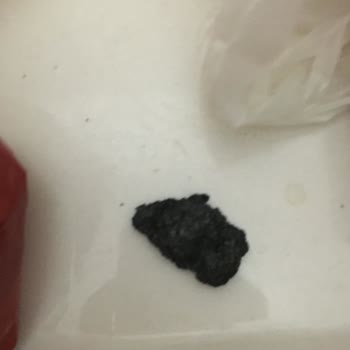 A101 Burch Mısır Gevreğinden Siyah Bir Madde Çıktı