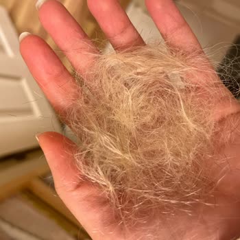 Loreal Paris Mor Şampuan Saç Dökülmesine Neden Oldu