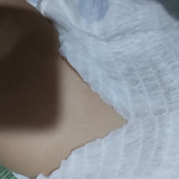 Molfix Bezlerinin Kalitesinin Düşürülmesi Ve Beni Zarara Sokması.