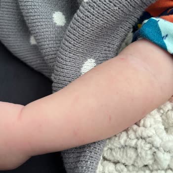 Kocaeli Şehir Hastanesi Bebekten Kan Almayı Beceremeyen Çocuk Hastalıkları Pol. Hemşireleri