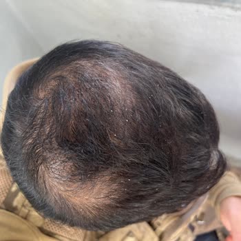 Batman Dünya Hastanesi Memnun Kalmadım!