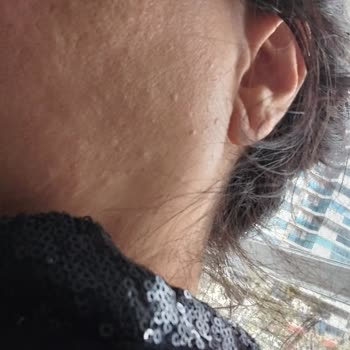 Yves Rocher Tonik Yüzümü Kötü Yaptı