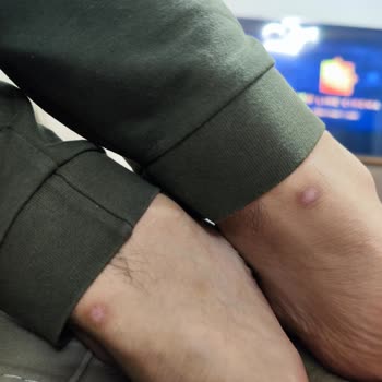 ADİDAS'ın Yavaş Hizmeti