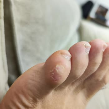 ADİDAS'ın Yavaş Hizmeti