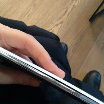 Omix X500 Batarya Şişmesi