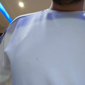 KİP Lekeli Ürün Gönderdi