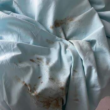 Tefal Ütü Sarı Su Akıtıyor