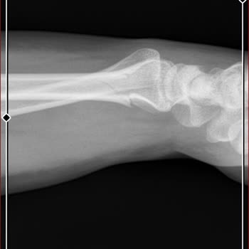 Taksim Eğitim ve Araştırma Hastanesi'nden Şikayetçiyim