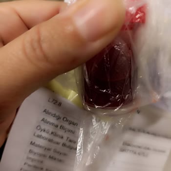 GetirYemek Patatesler Boyalı Çıktı