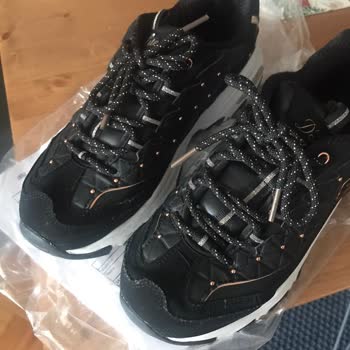 Skechers Ayakkabı Dikiş Patlaması Ve İnceleme Sorunu.