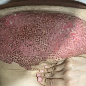 Dr. İsmail Bay Tarafından 2. Derece Yandım!