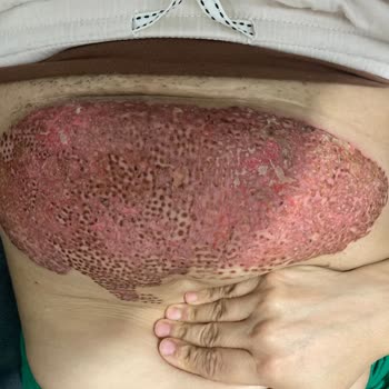 Dr. İsmail Bay Tarafından 2. Derece Yandım!