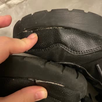 Skechers İmalat Hatasından Dolayı İki Tarafta Da Açılma
