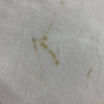 Arçelik Çamaşır Makinesi Pas Sorunu