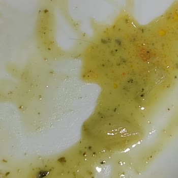 Tavuk Dünyası Restoranda Hijyen Sorunu