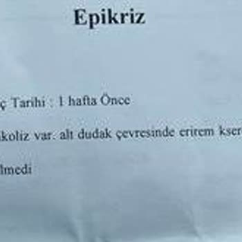 Anadolu Sigorta Ödeme Reddi Veriyor