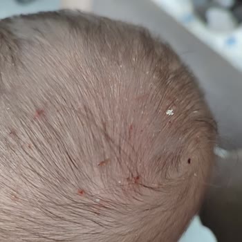 Mustela Konak Şampuan Yan Etki