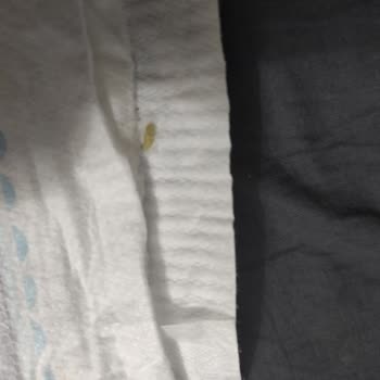 Molfix Bezde Kurt Çıktı