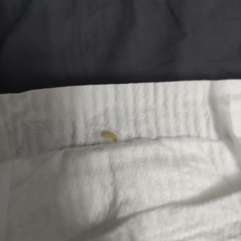 Molfix Bezde Kurt Çıktı