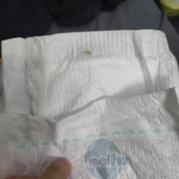 Molfix Bezde Kurt Çıktı