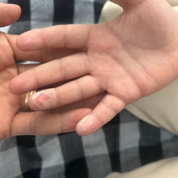 Özel Cihangir Hastanesi Çocuk Doktorundan Beklenmedik Tavır