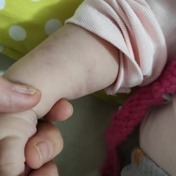 Yaşam Hastanesi (Kırıkkale) Bebeğimin Sağlığı İçin Götürdüğüm Hastane Ama Pişmanlık