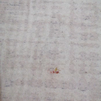 Yiğit Halı Yıkama Leke Çıkartamıyor Yırttığı Halıda Sorumluluk Almıyor