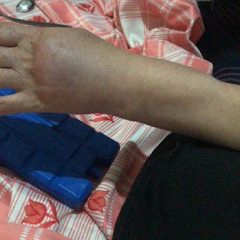 Konya Şehir Hastanesi Damar Yolu Açamıyorlar