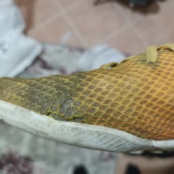 Adidas Sattığı Ürünün Arkasında Durmuyor