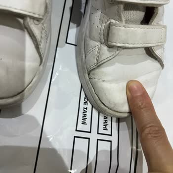 Adidas Ürün Bozukluğu Ayakkabı Açılması