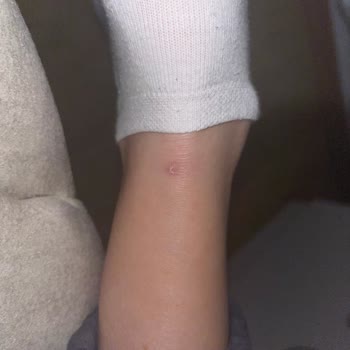 Hummel Marka Ayakkabının Vurması