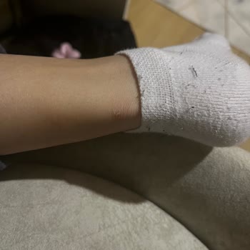 Hummel Marka Ayakkabının Vurması