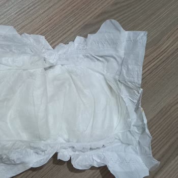 Baby Turco Hatalı Bez Kabusumuz Oldu.