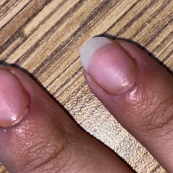 Ruj Nail Bar Manikür Sonucu Enfeksiyon