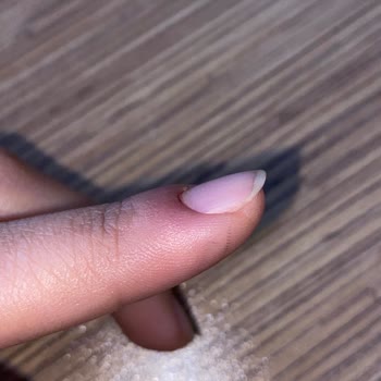 Ruj Nail Bar Manikür Sonucu Enfeksiyon